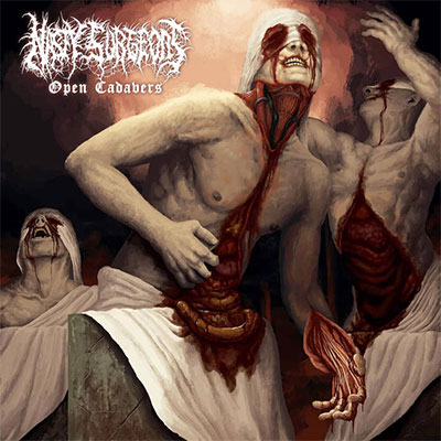 nasty_surgeons_open_cadavers